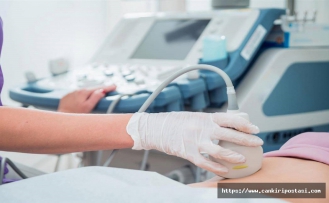 Üriner Ultrason İdrar Yolu Sağlığını Görüntülemenin Güvenli Yolu