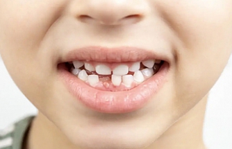Çocuklarda Diş Sağlığı Nasıl Olmalı?
